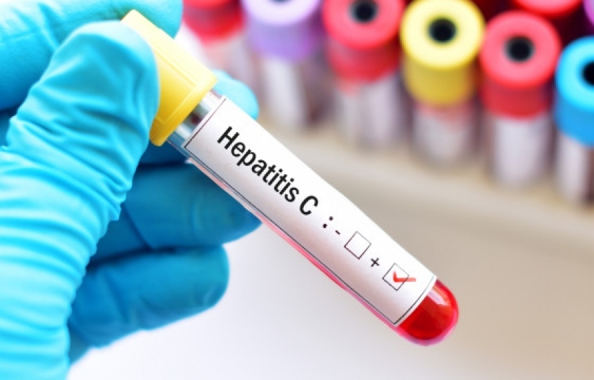 Тестват анонимно и безплатно за хепатит С и при нас