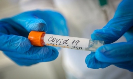 103 нови случаи на коронавирус при нас