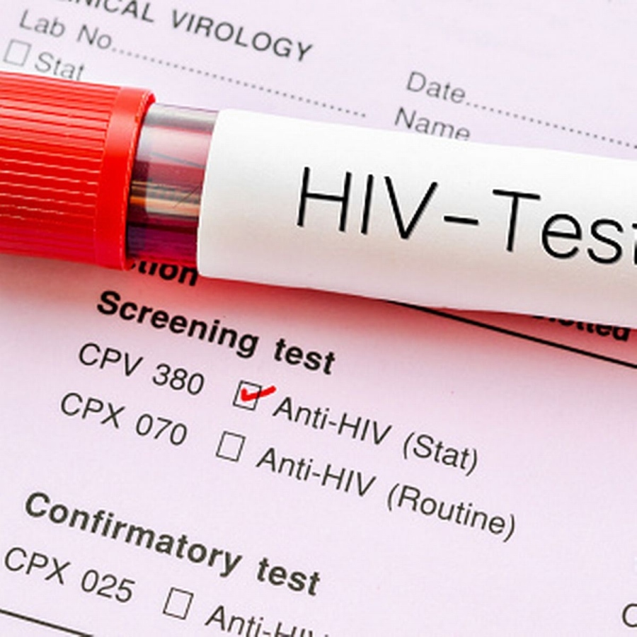 9 нови случая на инфектирани с ХИВ са открити в нашата област от началото на годината
