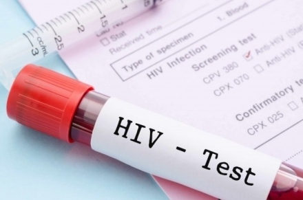 Проверете безплатно своя ХИВ-статус до края на август В РЗИ Пазарджик