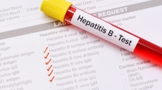 Изследват за хепатит с бързи тестове в Младежкия дом на 31 юли