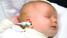 1 до 3 на 1000 деца имат проблеми със слуха